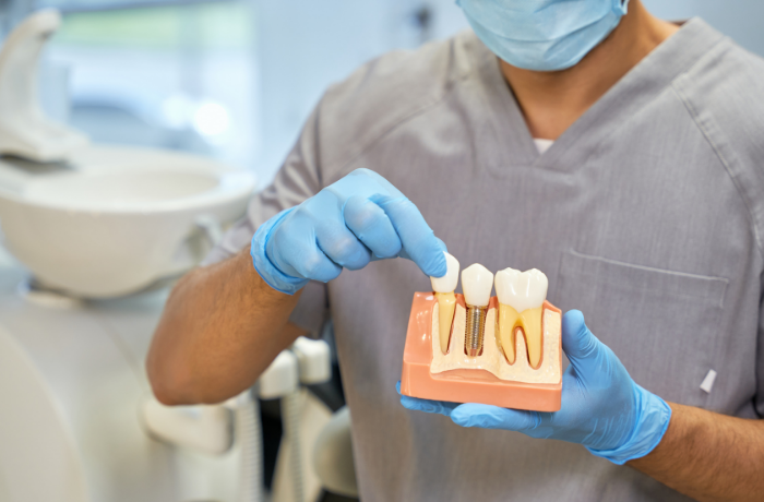 The Future of Dental Implants: 3D Computer-Guided Implant Placement in Dallas