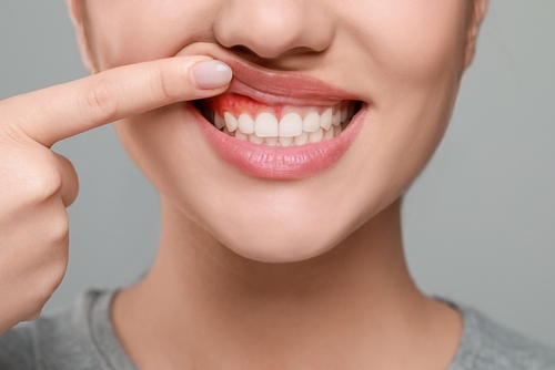 Why Your Dentist Measures Your Gums: A Simple Guide