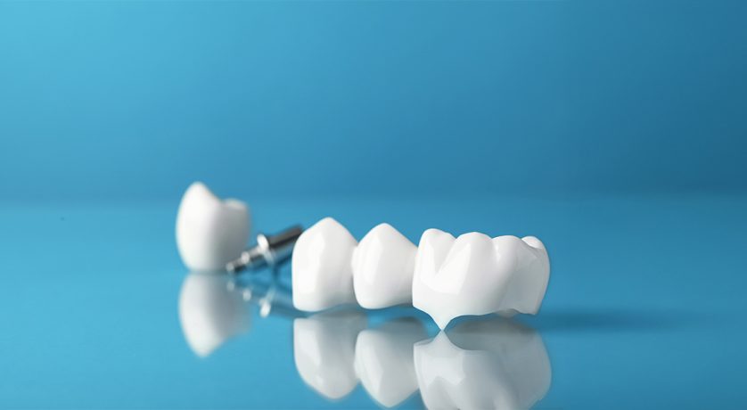 What Foods Should You Avoid with a Dental Crown?